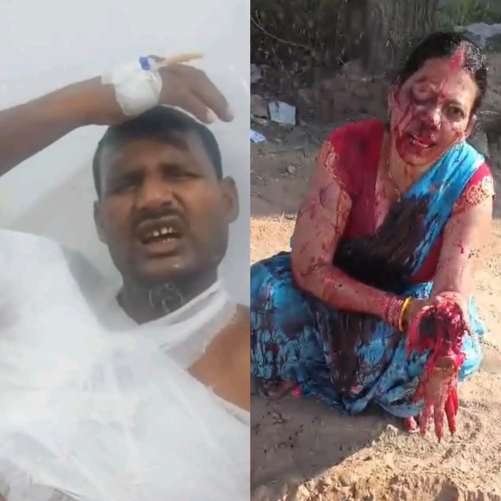 हिंदी समाचार |गोलीबारी पांच घायल देवर भाभी...
