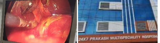 हिंदी समाचार | प्रकाश मल्टीस्पेशियलिटी...
