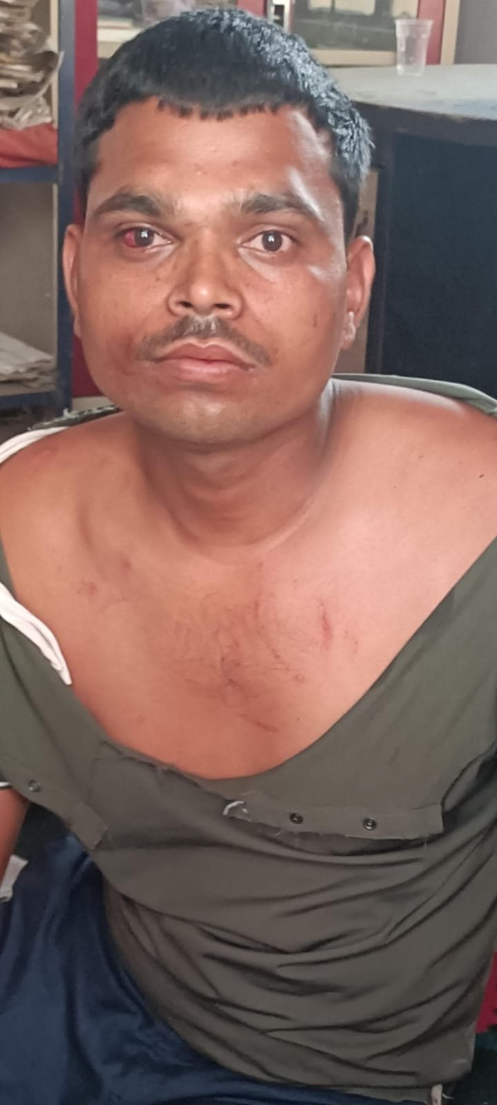 हिंदी समाचार | बीडीओ के पास शिकायत करना युवक...