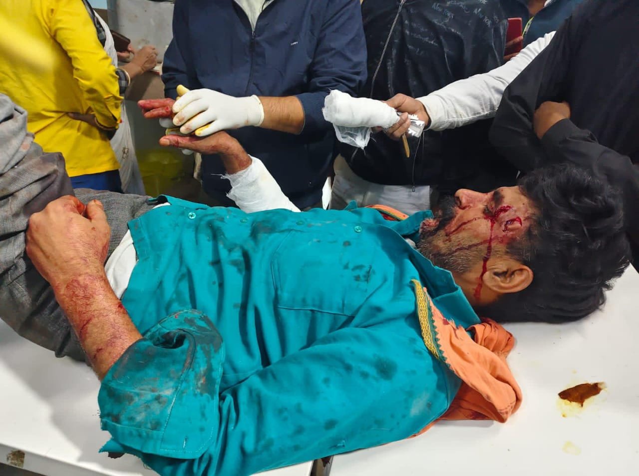 हिंदी समाचार |चिता की हमले एक घायल