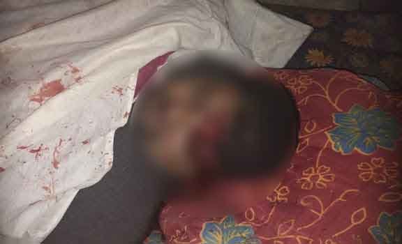 हिंदी समाचार |रात में युवक को मारी गोली